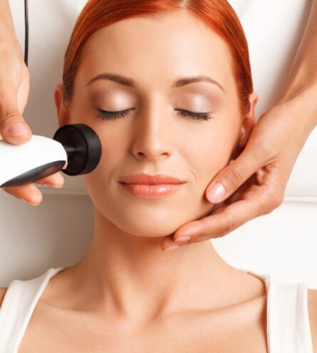 Radiofrecuencia facial